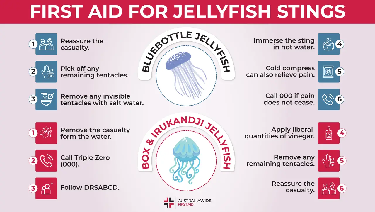 Infographic about First Aid for Jellyfish Stings